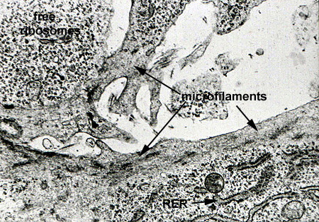 microfilaments electron microscopy